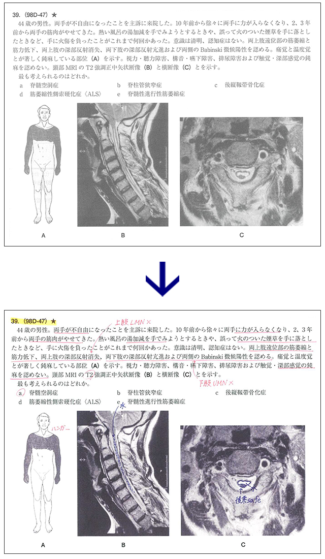 臨床問題イメージ